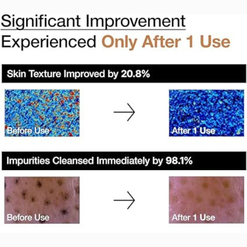 ANUA Brightening Rice Enzyme Cleansing Powder Gentle Facial Cleanser for Hydration Fragrance Free 40g 1.41oz